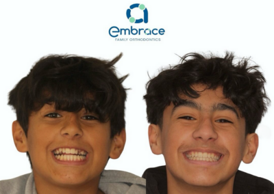 Embrace Family Orthodontics | Before and After Photos
