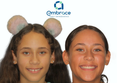 Embrace Family Orthodontics | Before and After Photos