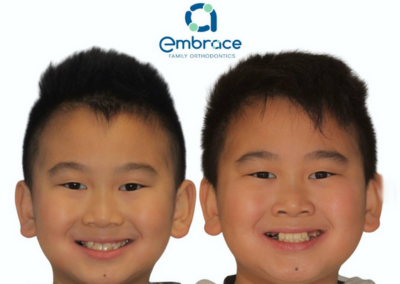 Embrace Family Orthodontics | Before and After Photos