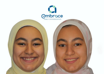Embrace Family Orthodontics | Before and After Photos