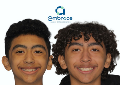 Embrace Family Orthodontics | Before and After Photos