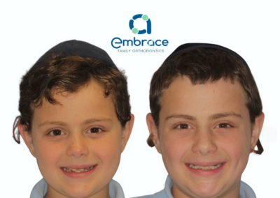 Embrace Family Orthodontics | Before and After Photos