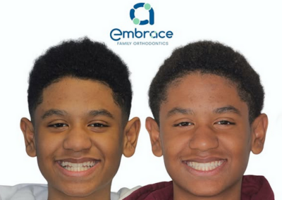 Embrace Family Orthodontics | Before and After Photos