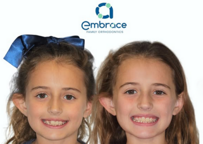Embrace Family Orthodontics | Before and After Photos